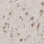 Immunohistochemical staining of human cerebral cortex shows moderate cytoplasmic positivity in neuronal cells.