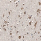 Immunohistochemical staining of human cerebral cortex shows moderate cytoplasmic positivity in neuronal cells.
