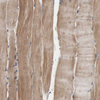 Immunohistochemical staining of human skeletal muscle shows weak cytoplasmic positivity in myocytes.