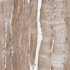Immunohistochemical staining of human skeletal muscle shows weak cytoplasmic positivity in myocytes.