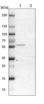 Lane 1: NIH-3T3 cell lysate (Mouse embryonic fibroblast cells)_br/_Lane 2: NBT-II cell lysate (Rat Wistar bladder tumour cells)
