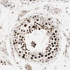 Immunohistochemical staining of human testis shows high expression.