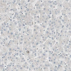 Immunohistochemical staining of human liver shows low expression as expected.