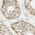 Anti-KIF11 Antibody