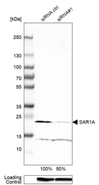 Western blot analysis in A-431 cells transfected with control siRNA, target specific siRNA probe #1, using Anti-SAR1A antibody. Remaining relative intensity is presented. Loading control: Anti-GAPDH.