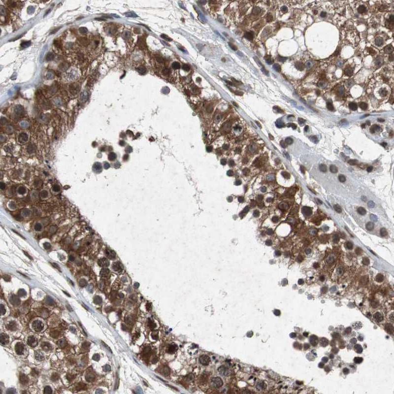 Anti-SLC27A3 Antibody