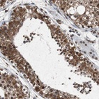 Anti-SLC27A3 Antibody