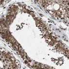 Anti-SLC27A3 Antibody