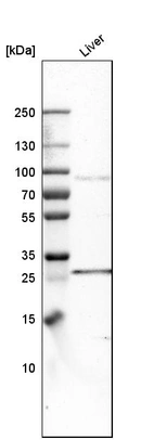 Western blot analysis in human liver tissue.
