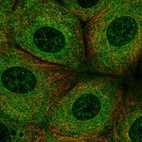 Immunofluorescent staining of human cell line MCF7 shows localization to endoplasmic reticulum.