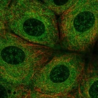 Immunofluorescent staining of human cell line MCF7 shows localization to endoplasmic reticulum.