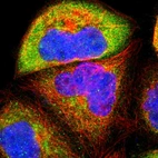 Immunofluorescent staining of human cell line A-431 shows localization to cytosol.