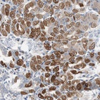 Anti-PBXIP1 Antibody