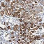 Anti-PBXIP1 Antibody