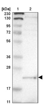 Lane 1: Marker [kDa] 230, 130, 95, 72, 56, 36, 28, 17, 11_br/_Lane 2: Human cell line RT-4