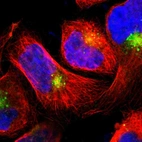 Immunofluorescent staining of human cell line A-431 shows localization to nucleoplasm & vesicles.