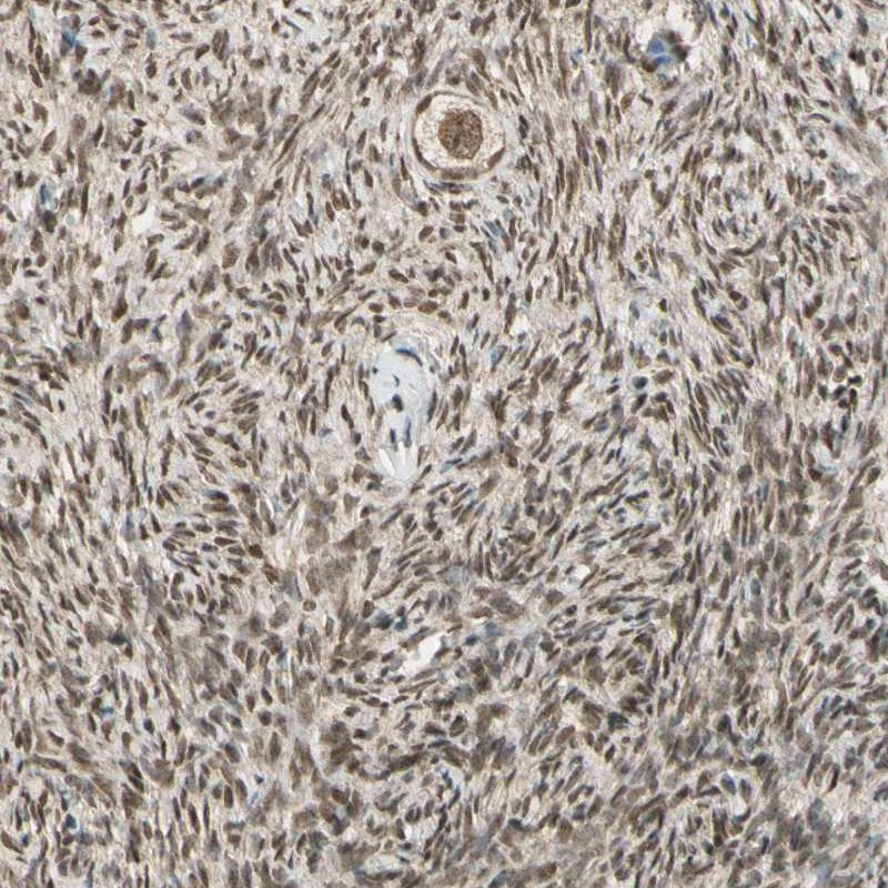 Anti-ZNF135 Antibody