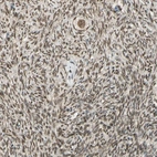 Anti-ZNF135 Antibody
