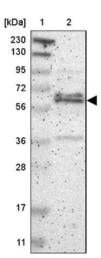 Anti-ZNF135 Antibody