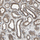 Immunohistochemical staining of human kidney shows moderate to strong cytoplasmic positivity in cells in tubules.