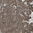 Immunohistochemical staining of human pancreas shows moderate to strong cytoplasmic positivity in exocrine glandular cells.