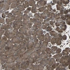 Immunohistochemical staining of human pancreas shows moderate to strong cytoplasmic positivity in exocrine glandular cells.