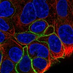 Immunofluorescent staining of human cell line RT4 shows localization to plasma membrane.