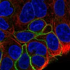 Immunofluorescent staining of human cell line RT4 shows localization to plasma membrane.