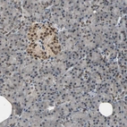 Anti-PHC1 Antibody