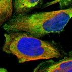 Immunofluorescent staining of human cell line U-2 OS shows localization to cytosol.