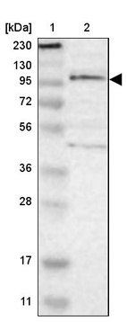 Lane 1: Marker [kDa] 230, 130, 95, 72, 56, 36, 28, 17, 11_br/_Lane 2: Human cell line RT-4