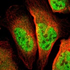 Immunofluorescent staining of human cell line U-2 OS shows localization to nucleoplasm.