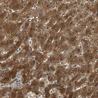 Anti-PRDX6 Antibody