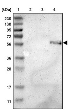 Lane 1: Marker [kDa] 230, 130, 95, 72, 56, 36, 28, 17, 11_br/_Lane 2: Human cell line RT-4_br/_Lane 3: Human cell line U-251MG sp_br/_Lane 4: Human plasma (IgG/HSA depleted)