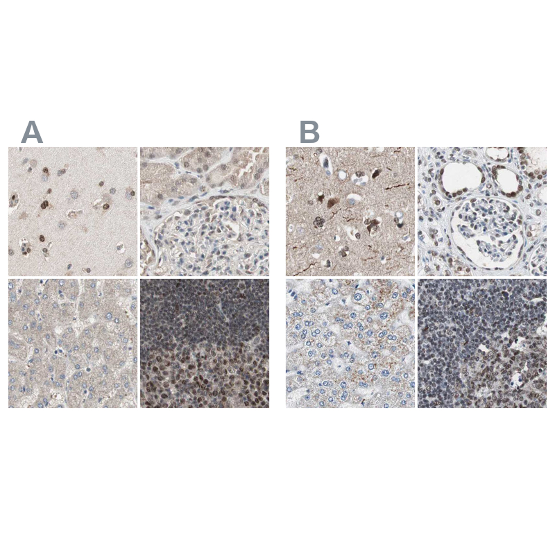 Anti-ZHX2 Antibody