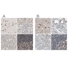 Anti-ZHX2 Antibody