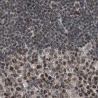Immunohistochemical staining of human lymph node using Anti-ZHX2 antibody HPA006996.