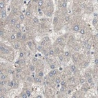 Immunohistochemical staining of human liver using Anti-ZHX2 antibody HPA006996.