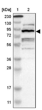 Lane 1: Marker [kDa] 230, 130, 95, 72, 56, 36, 28, 17, 11_br/_Lane 2: Human cell line RT-4