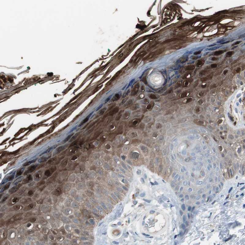 Anti-S100A7 Antibody