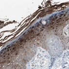 Anti-S100A7 Antibody