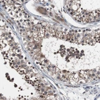 Immunohistochemical staining of human testis shows weak to moderate nuclear and cytoplasmic positivity in cells in seminiferous ducts.