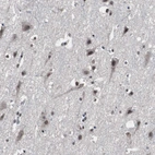 Immunohistochemical staining of human cerebral cortex shows moderate nuclear positivity in neurons and glial cells.