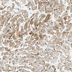 Immunohistochemical staining of human heart muscle shows strong cytoplasmic positivity in cardiomyocytes.