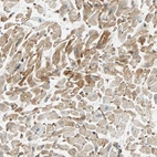 Immunohistochemical staining of human heart muscle shows strong cytoplasmic positivity in cardiomyocytes.