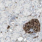 Immunohistochemical staining of human kidney shows strong cytoplasmic positivity in cells in glomeruli.