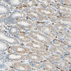 Immunohistochemical staining of human gastrointestinal shows moderate cytoplasmic positivity in glandular cells.