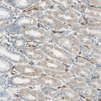 Immunohistochemical staining of human gastrointestinal shows moderate cytoplasmic positivity in glandular cells.