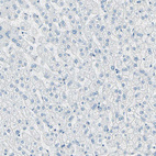 Immunohistochemical staining of human liver shows negative cytoplasmic positivity in glandular cells as expected.