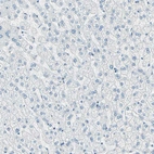 Immunohistochemical staining of human liver shows negative cytoplasmic positivity in glandular cells as expected.